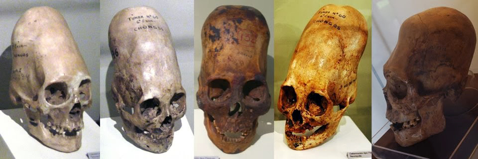 Paracas Skulls